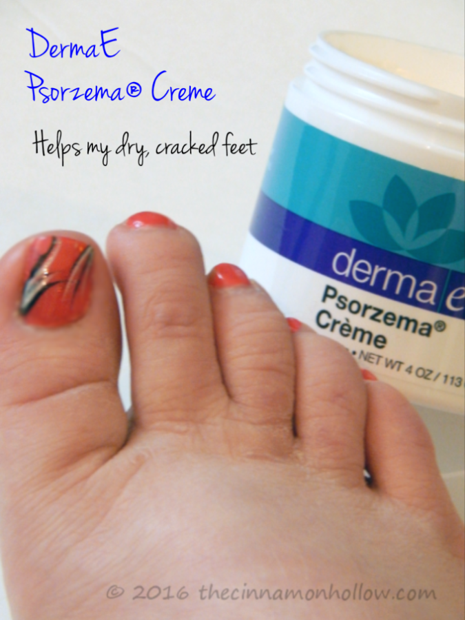 Derma E Psorzema Skin Care - Dry Cracked Feet - Relieve Itchy Scalp And Soothe Eczema And Psoriasis