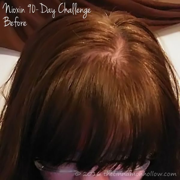 Nioxin 90 Day Challenge - Hair Loss Regrowth