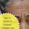 How To Get Rid Of Untimely Forehead Lines Naturally