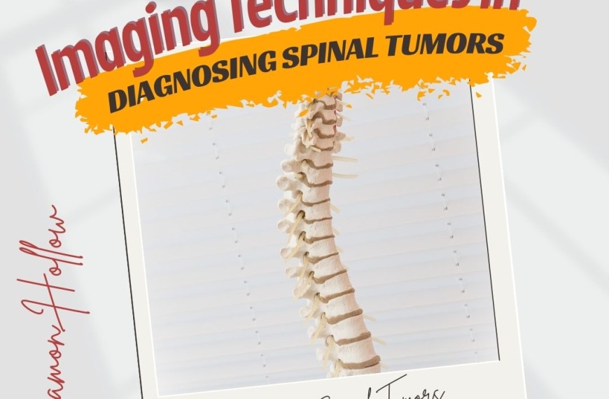 Diagnosing Spinal Tumors