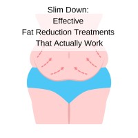 Effective Fat Reduction Treatments