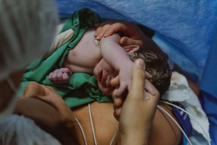 9 Common Birth Injuries and Their Long-Term Implications
