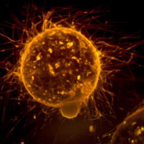 How To Recognize Skin Cancer
