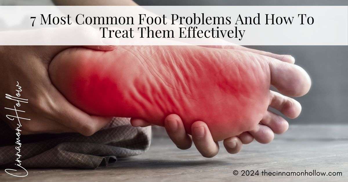 Common Foot Problems