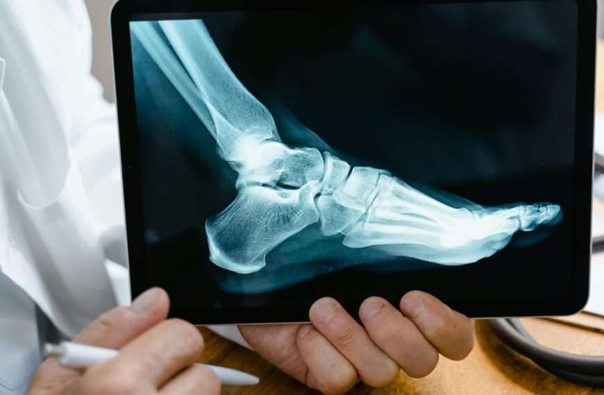 injured while working