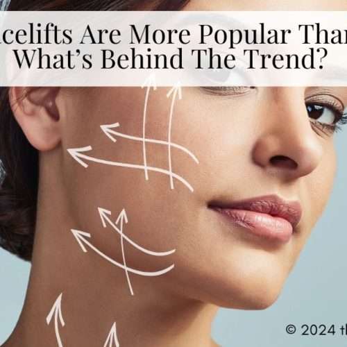 facelifts