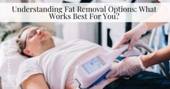 fat removal options