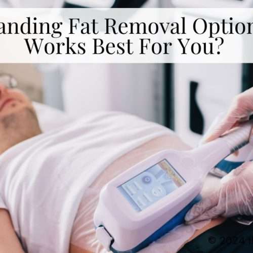 fat removal options