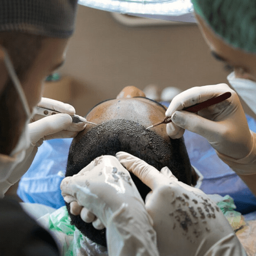 Follicular Unit Extraction