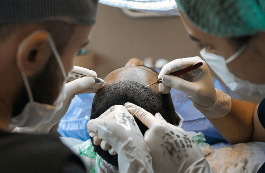 Follicular Unit Extraction
