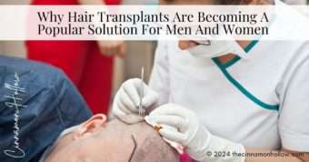 hair transplants