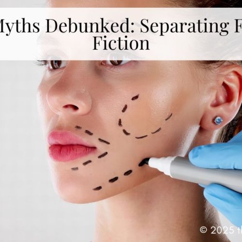 Facelift Myths