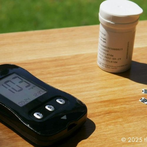 insulin resistance affects weight loss