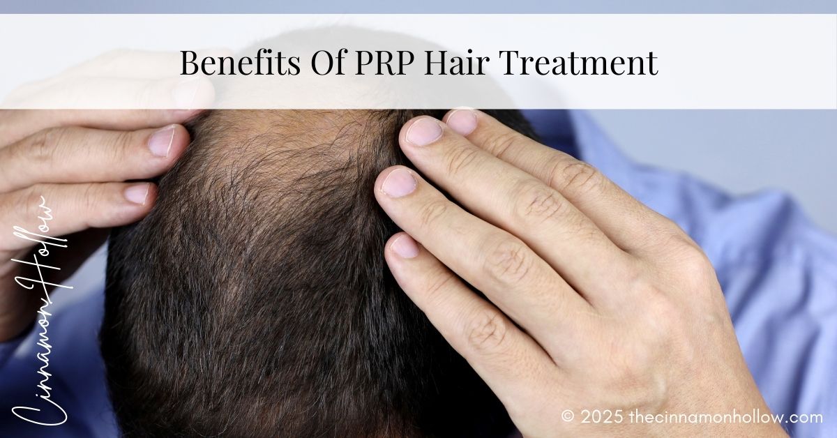 PRP Hair Treatment For Hair Loss