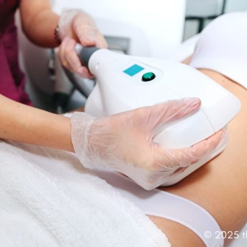 CoolSculpting