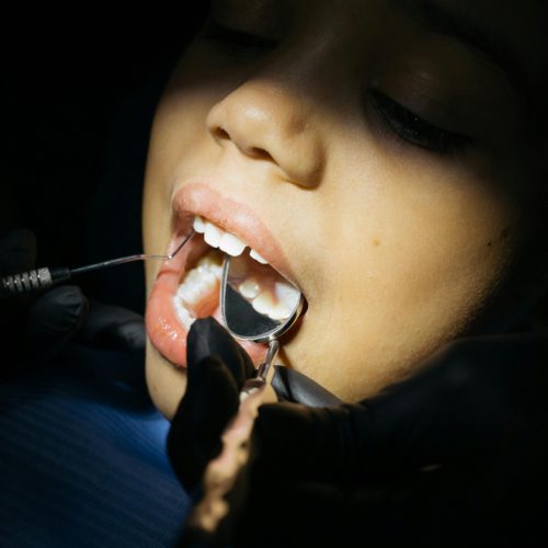 How to Keep Your Teeth Looking Good