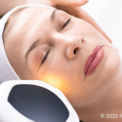 Laser Resurfacing