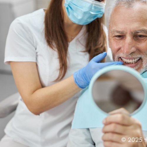 full-mouth dental implants