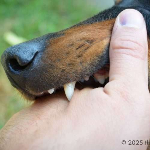 dog bite injury claim