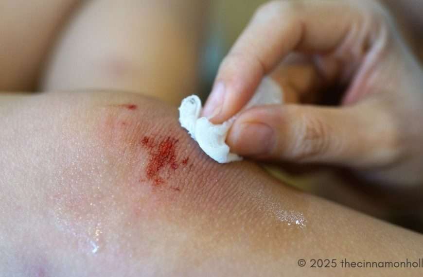 caring for wounds