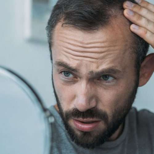 hair loss
