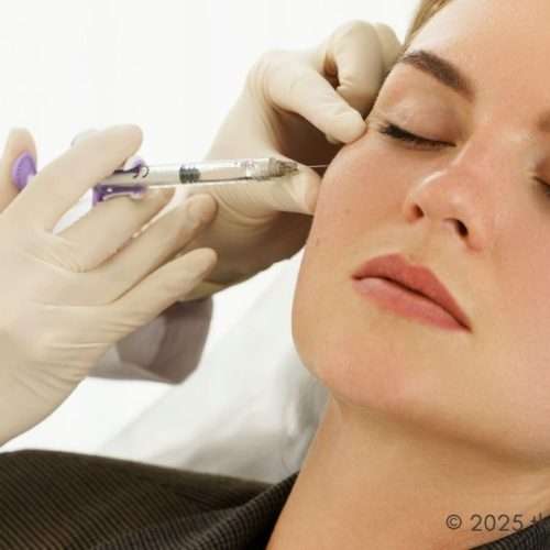 Facial Fillers
