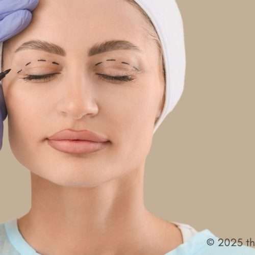 eyelid lift - eyelid surgery