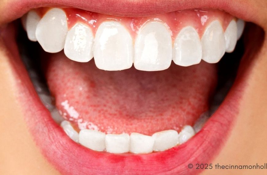 full mouth reconstruction