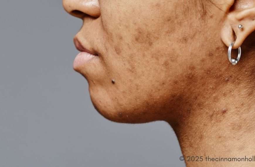 pigmentation spots
