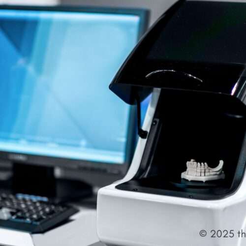 CAD/CAM scanner - dental technology