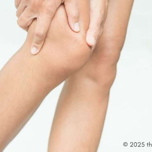 Joint disorders