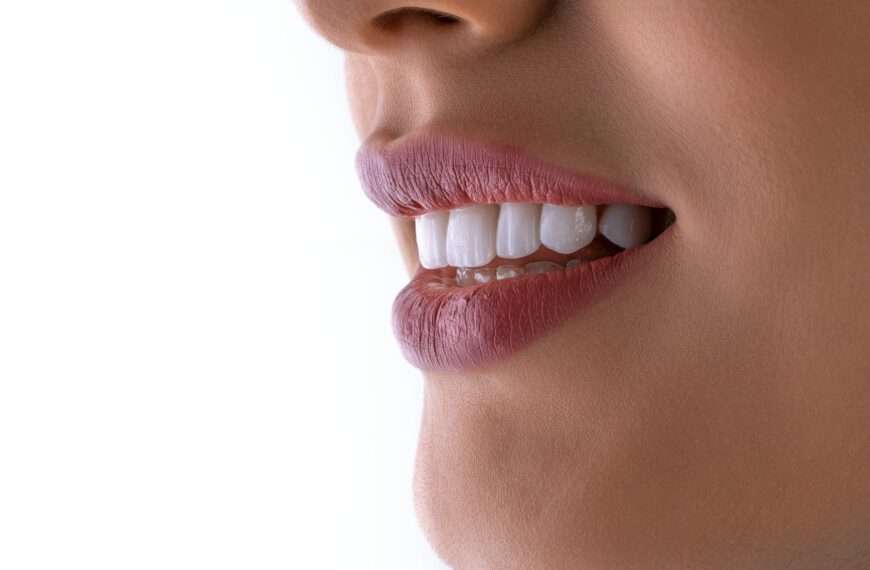 dental health