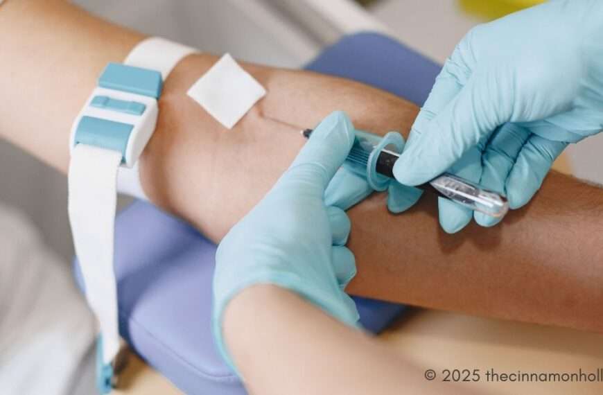 Vein Treatment