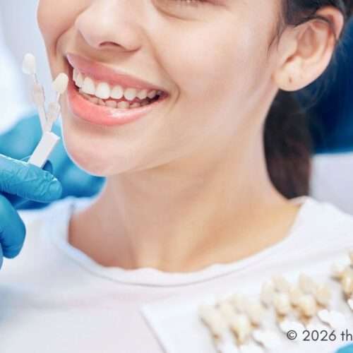 Veneers, crowns, and whitening - veneer treatments