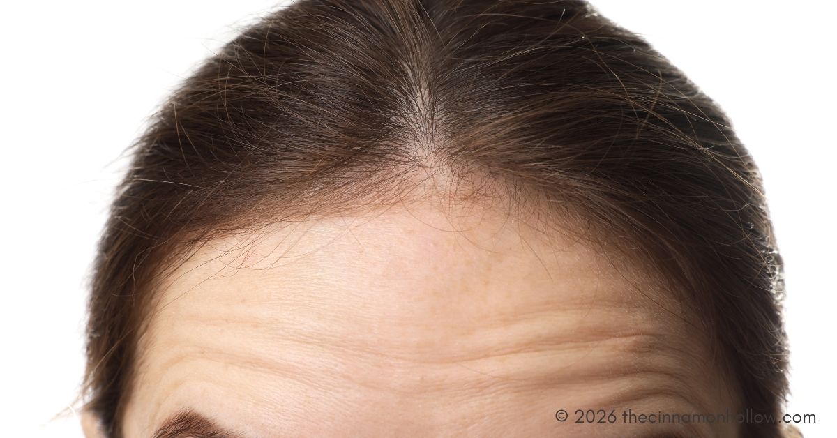 Forehead Lifts