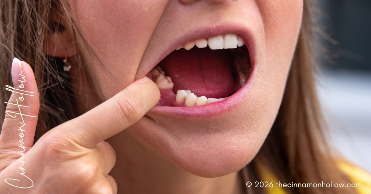 missing tooth