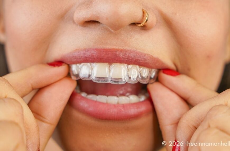 Clear Aligners