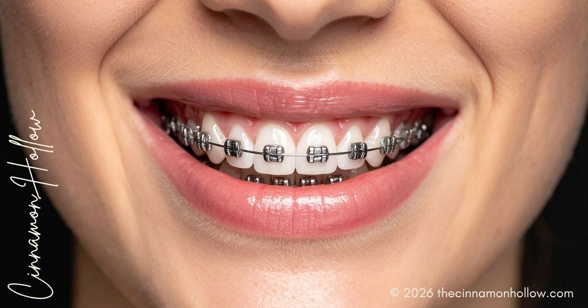 braces Pine Dentistry