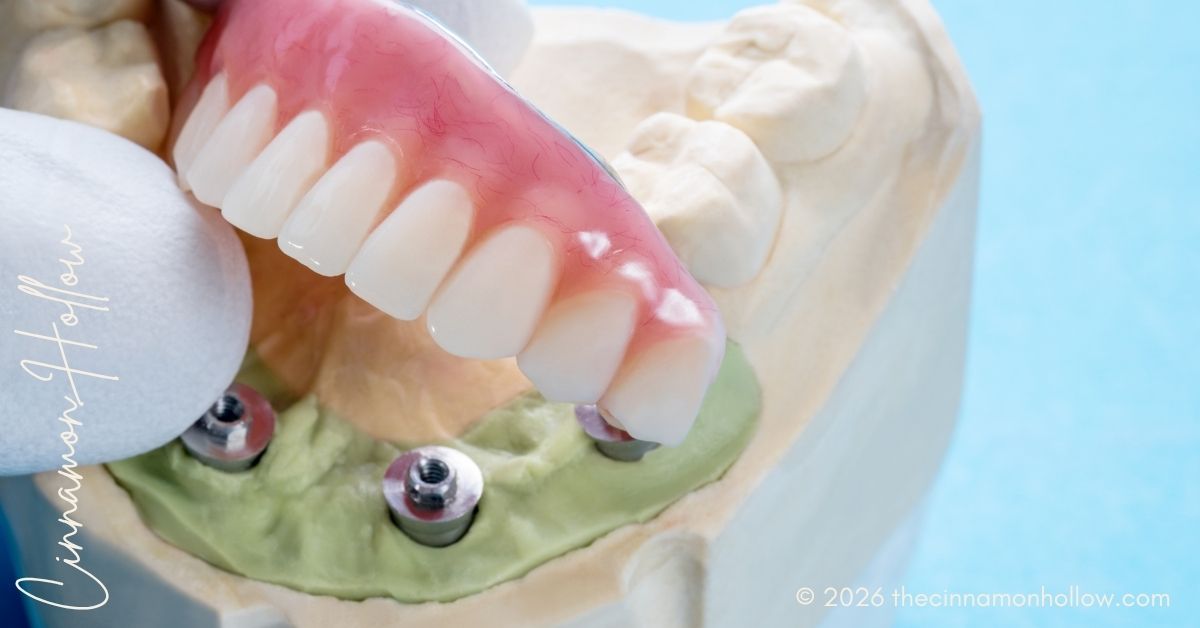 reasons patients prefer implants to traditional dentures