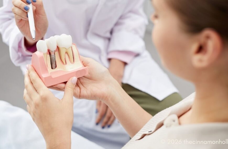 mini dental implants
