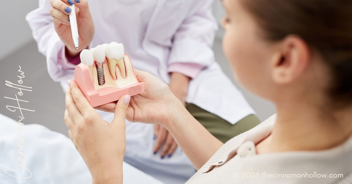 mini dental implants