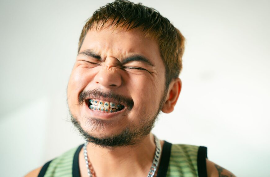 braces for crooked teeth