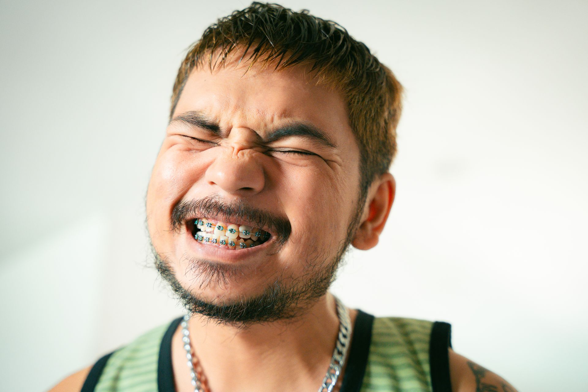 braces for crooked teeth