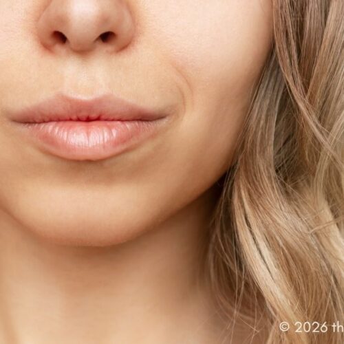 Buccal Fat Pad Removal