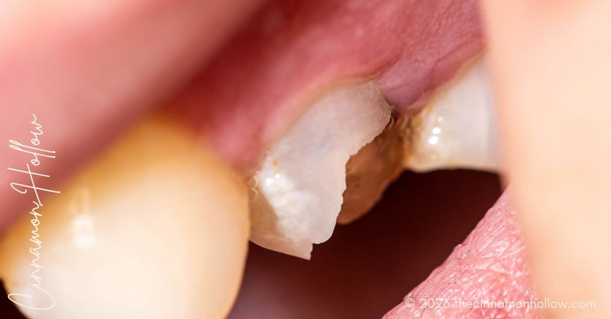 Tooth Damage
