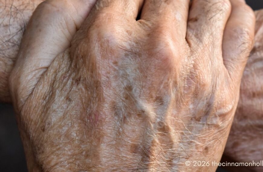fading age spots