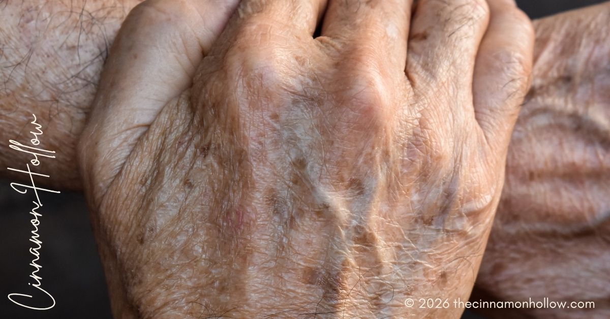fading age spots