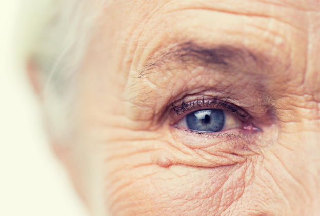 Age-Related Changes Around the Eyes