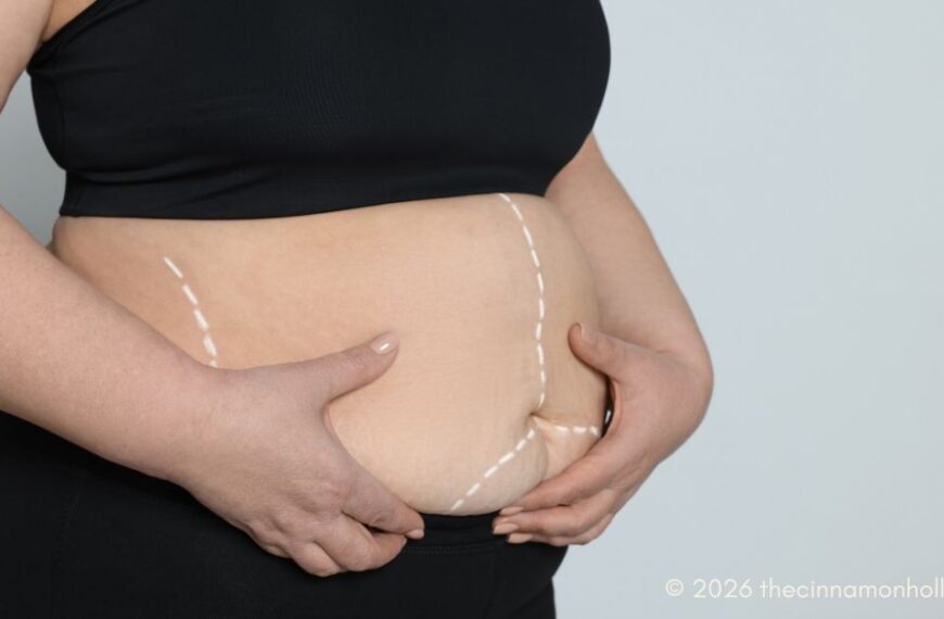 Bariatric Surgery