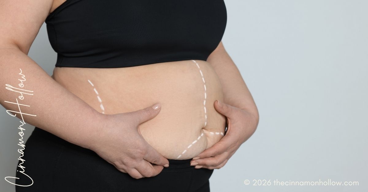 Bariatric Surgery